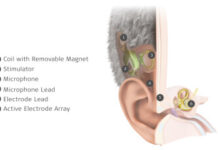 MED-EL Launches World’s First Commercially Available Totally Invisible Cochlear Implant